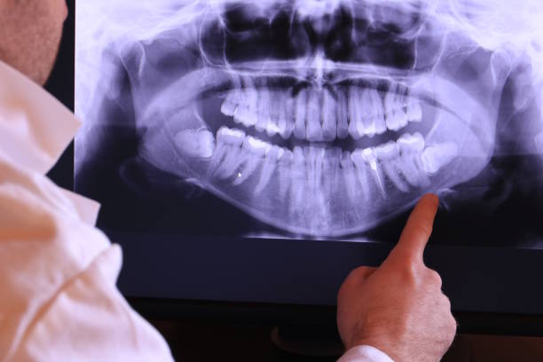 Best Emergency Dentist for Knocked-Out Tooth in Benicia, CA