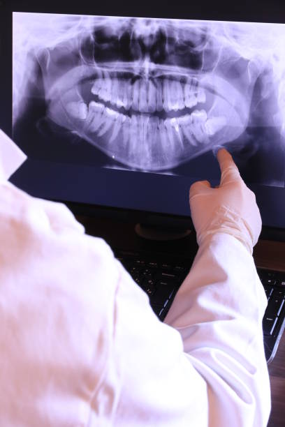 Best Emergency Dentist for Knocked-Out Tooth in Benicia, CA